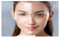 吃海鮮對(duì)于使用瘦腿針的人來(lái)說(shuō)是否適合？