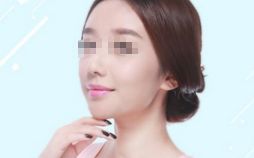 雙眼皮修復(fù)，選對(duì)時(shí)機(jī)，展現(xiàn)美麗眼眸