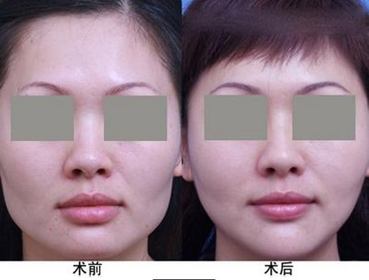 生姜洗發(fā)水哪個(gè)牌子好用，一線大品牌值得推薦