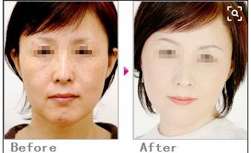 獨(dú)家分享！塌鼻子的完美發(fā)型指南，為你打造精致生活