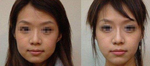 長期外眼角傷害視力？這樣保護(hù)眼睛更有效！
