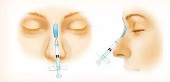 美白祛斑的方法有哪些？4種醫(yī)美美肌方案推薦