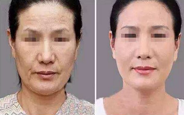 如何讓幼態(tài)臉變得緊致有型？塑造迷人圓潤(rùn)臉型攻略揭秘！
