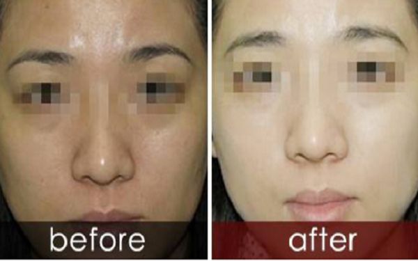 曬黑后如何迅速變白？曬黑美白需要持續(xù)護(hù)理多久結(jié)果可見(jiàn)？了解曬后護(hù)膚科普！