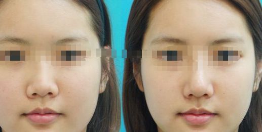 紀(jì)輝私人制造設(shè)備，安全可靠嗎？