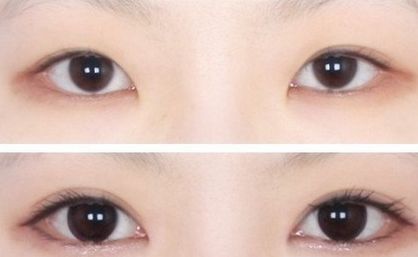 南京中醫(yī)院優(yōu)秀雙眼皮專家推薦，值得信賴！完善的醫(yī)生介紹、項目介紹及價格表供參考