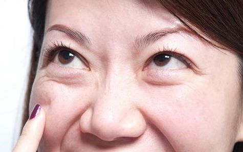 上海九院去眼袋專家推薦，最全擅長項目及費用一覽