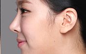 東莞第五人民醫(yī)院美容科綜合評(píng)價(jià)及專家推薦！