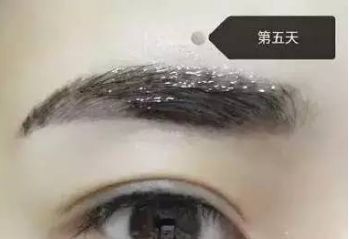 南昌美伊爾劉立軍醫(yī)生膨體隆鼻整形費用？手術效果如何？帶您看醫(yī)生案例