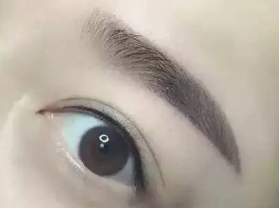 周兆平醫(yī)生雙眼皮手術(shù)需等候排隊嗎？醫(yī)生經(jīng)歷&案例顯示，2023瞳瞳提升策略！