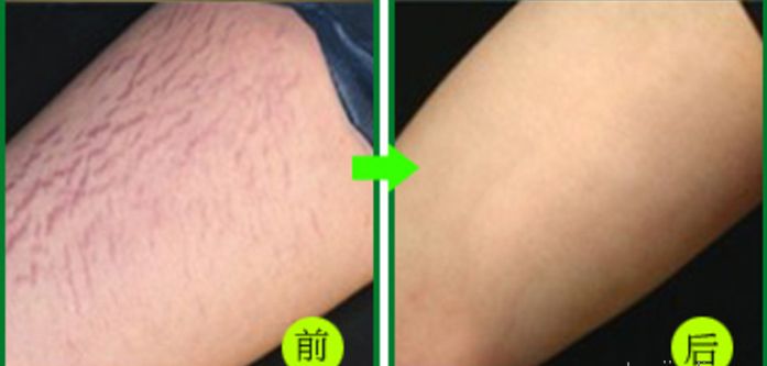 杭州地道整形好醫(yī)院推薦，當?shù)鼐用窳λ]的高水平醫(yī)療機構(gòu)