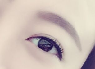 劉春軍豐胸手術(shù)后效果如何？費(fèi)用怎么樣？醫(yī)生概況+隆胸真實(shí)案例圖為參考