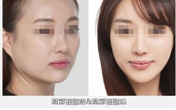 2024年昆明哪家整形醫(yī)院更受歡迎？你一定不知道！