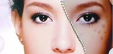 周一雄如何預(yù)約雙眼皮手術(shù)？案例分享與價(jià)格真實(shí)評(píng)估