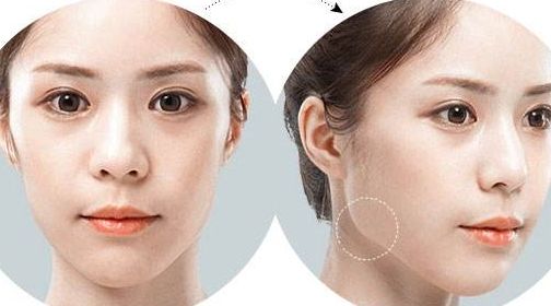 南京乳房美容醫(yī)院推薦，頂級(jí)醫(yī)療機(jī)構(gòu)推薦閱讀