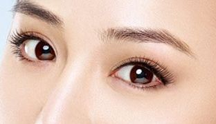 成都米蘭柏羽雙眼皮曝光！醫(yī)生做雙眼皮風(fēng)格如何？對比照片供參考