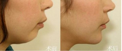 國(guó)內(nèi)知名的脫發(fā)治療機(jī)構(gòu)有哪些？這三家你必須了解