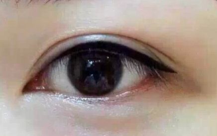 上海9院專家分享軟骨隆鼻案例，LiQingfeng的技術(shù)備受推崇！