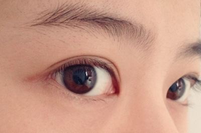 如何選擇適合自己的祛斑醫(yī)院？哪些醫(yī)院是值得嘗試的？