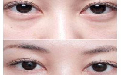 云南雙眼皮醫(yī)生排行榜2023：揭秘5位頂尖專家，讓您輕松煥發(fā)雙目魅力！
