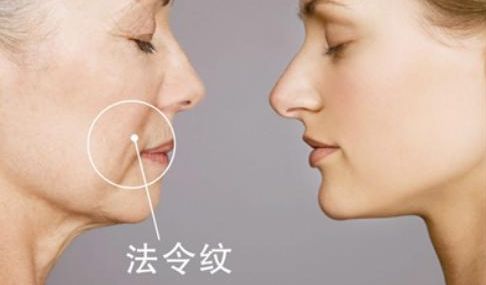 武漢雙眼皮醫(yī)生哪些技術強？陳宏案例揭秘前五強！