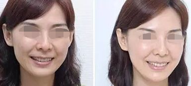 佛山哪家整形醫(yī)院超好的，超皮秒技術(shù)厲害的名單公布