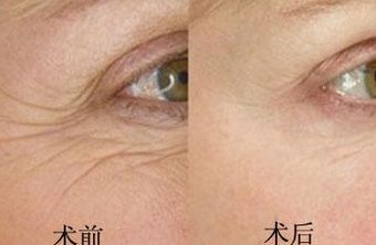 南京鳳凰島整形外科門診部的王科醫(yī)生口碑如何？聯(lián)合李敏醫(yī)生介紹及手術(shù)后的反饋，揭秘這位醫(yī)生的實力！