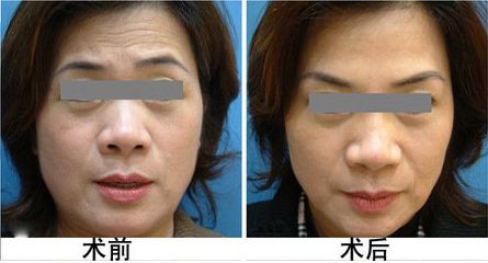 廣安阿藍(lán)醫(yī)院整形科評價(jià)，是否正規(guī)？地址詳細(xì)一覽