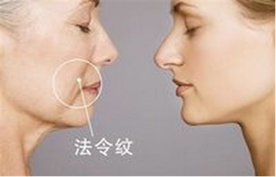 美麗改變，趙德星鼻子整形前后對(duì)比，驚艷有度！