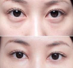 上海美萊醫(yī)院的療效一流，備受好評(píng)的醫(yī)生大揭秘！