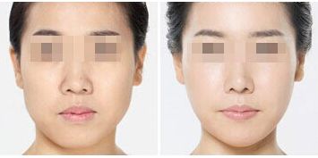深圳整形美容醫(yī)院排名前十，哪家更受用戶好評(píng)？