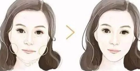 廣州拉皮手術(shù)哪里做效果好？華美、曙光等知名醫(yī)院上榜！