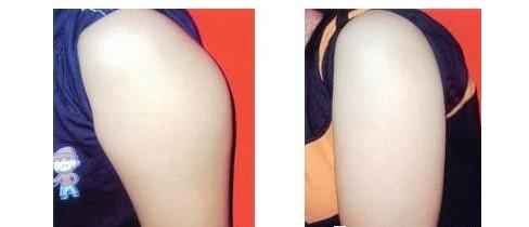 上海九院的整形價(jià)格表是怎樣的？它適合想要變美的人嗎？