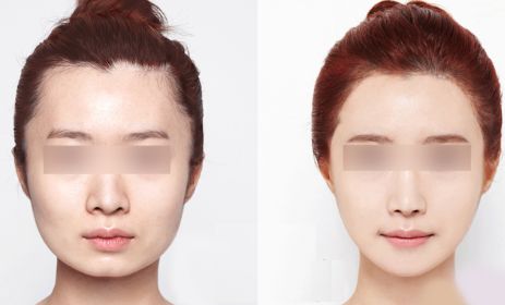 昆明哪里有最好的眼部手術(shù)整形醫(yī)院？2024年10家排名搶先曝光！