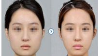 【2024】杭州十大值得信賴的整形美容醫(yī)院推薦！