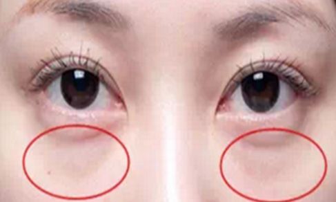 哪位醫(yī)生在八大處能夠?yàn)槟龀鐾昝赖碾p眼皮手術(shù)？手術(shù)價(jià)格信息附后