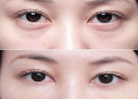 北京最受歡迎的整形醫(yī)院排名高居前三！私立醫(yī)美實力超越公立醫(yī)院！