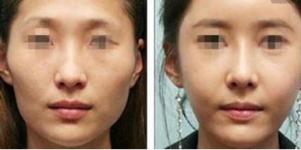 廣州市有哪家醫(yī)療機構提供出色的醫(yī)美美容科服務？這些被公認為優(yōu)質(zhì)的醫(yī)療機構都值得關注