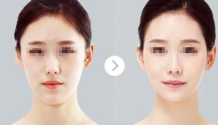 鄭州哪家醫(yī)院比較好做唇部整形？