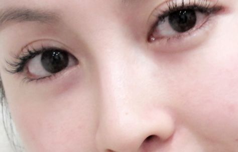 廣州熱瑪吉授權(quán)醫(yī)院有哪些好？