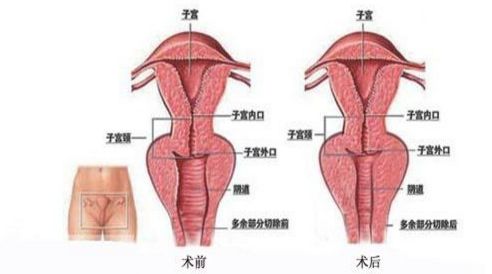 上海祛斑哪家醫(yī)院技術(shù)專業(yè)，效果有保障