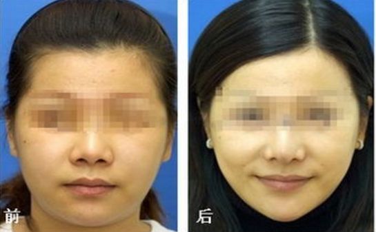 湖北整形醫(yī)院，揭曉精選名單！武漢美顏殿堂、技藝巔峰異軍突起