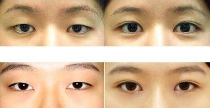 上海眼王醫(yī)生排行榜前五名大咖介紹，助您尋找頂級專家