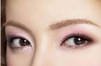 北京協(xié)和醫(yī)院白明醫(yī)生的雙眼皮手術(shù)效果如何？真實(shí)案例展示給你看