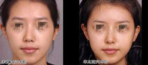廣州雙眼皮整形市場(chǎng):熱門口碑機(jī)構(gòu)選擇這幾家準(zhǔn)沒錯(cuò) 廣州雙眼皮整形市場(chǎng):熱門口碑機(jī)構(gòu)選擇這幾家準(zhǔn)沒錯(cuò)