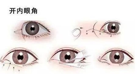 廣州畸形耳朵手術(shù)？值得收藏的醫(yī)院推薦！