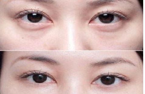 沈陽哪個醫(yī)院的整形專家口碑好，醫(yī)術(shù)高超的醫(yī)生推薦