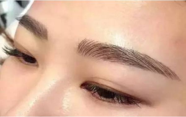 何晉龍磨骨成功，面容煥然一新！讓人難以置信的手術(shù)效果！