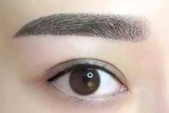 李發(fā)成整容之精彩案例分享，認識中國醫(yī)學(xué)科學(xué)院整形外科醫(yī)院