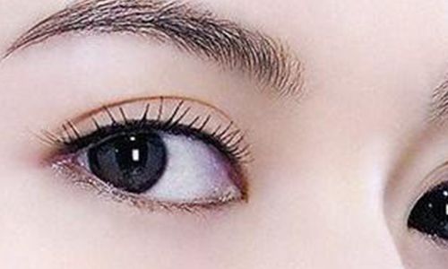 太玲美眸重現(xiàn)！揭秘雙眼皮新趨勢(shì)，驚艷效果讓人眼前一亮